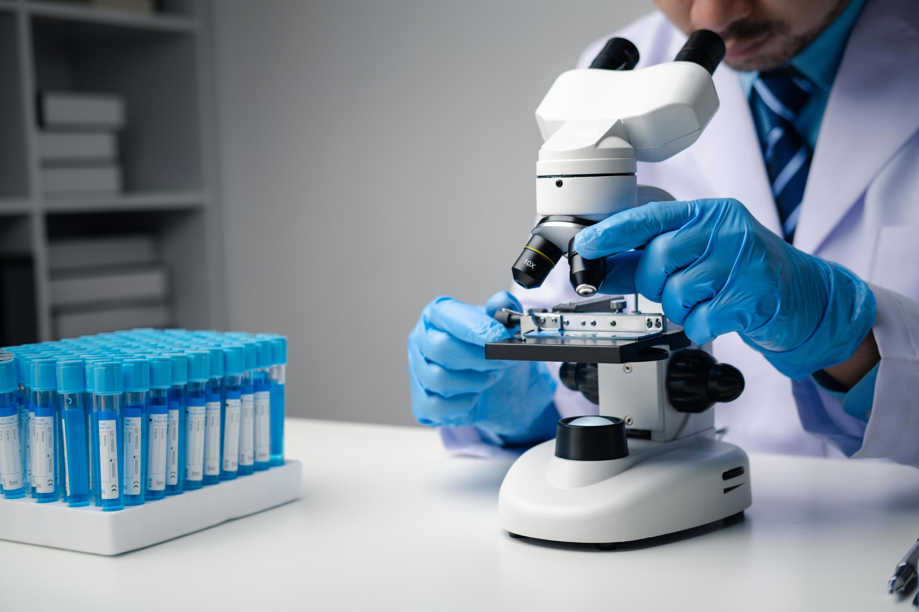 Scientist in blue gloves examining samples with a microscope in a medical laboratory